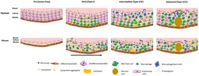 Smooth Muscle Cell—Macrophage Interactions Leading to Foam Cell Formation in Atherosclerosis: Location, Location, Location